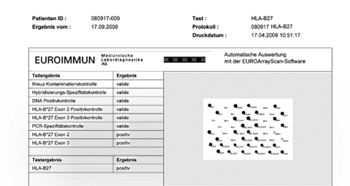 microarray_befund.jpg